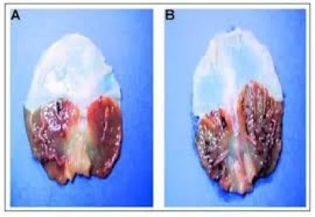 melatonin_brain